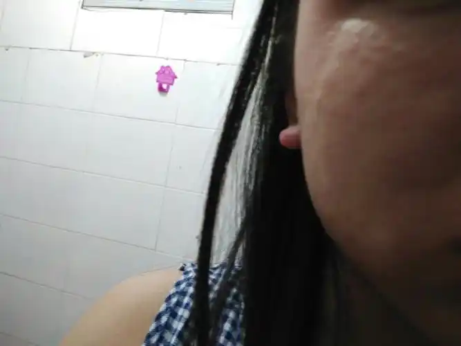 脸上化妆品过敏 吃药后没用而且越来越厉害 怎么办啊.