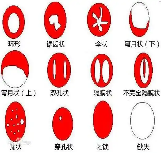 千万不要跟非处女结婚