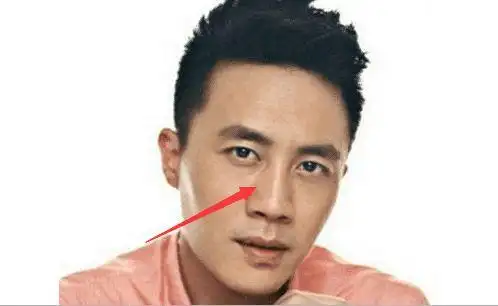 鼻头尖肖有如锥子,鼻梁露骨有如刀锋的,即使家富万贯,也是富屋贫人