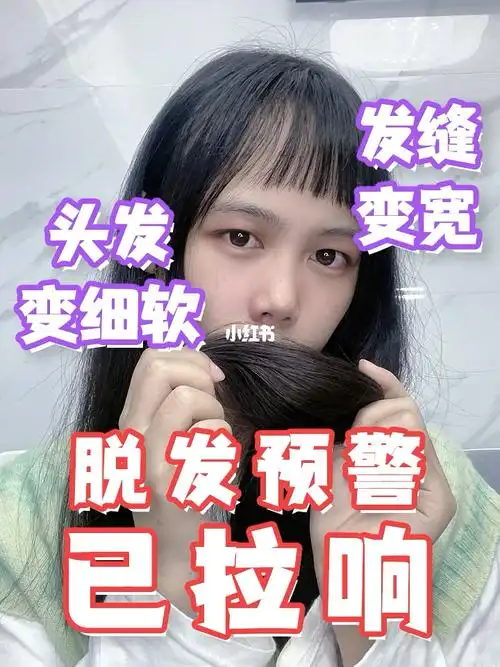 很多女生的头发变细变软头顶发缝变宽0505