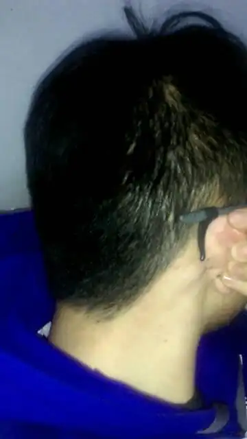 耳朵后面长了个疙瘩如图,这是啥啊,不按不疼,一按就疼,昨天刚感觉手脚