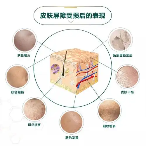 皮肤屏障通常指的是皮肤的表层,主要由皮脂膜和角质层组成.