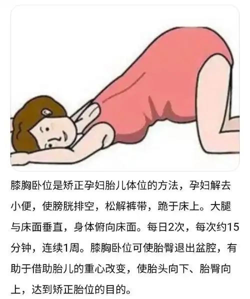 孕34w横头转臀位转头位转胎位经验分享