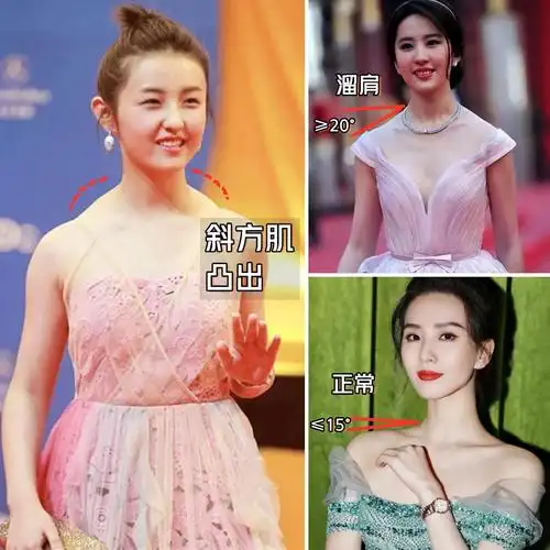 第一个: 脖子前倾脖子前倾就是我们常说的"缩头缩脑",正常站立的时候