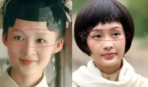 韩国欧佩拉整形外科