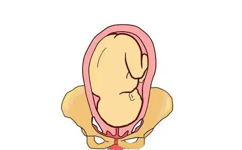 loa胎位图是什么意思呢