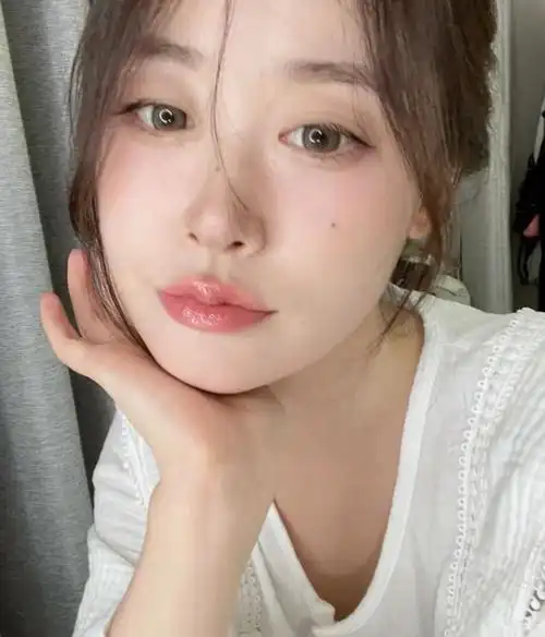 美人痣图片高清大图