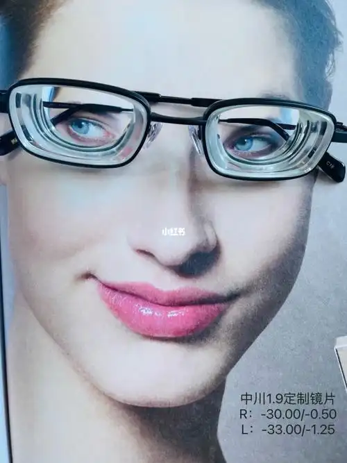 look别发呆高度近视3300散光150度的眼镜