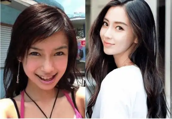 杨颖出道前"丑照"曝光,遭质疑整容,回应:当时确实很丑_进行_孩子_家长