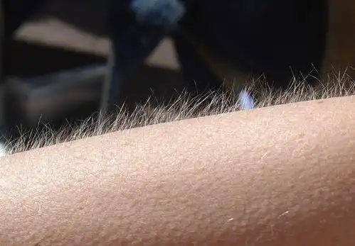 为啥有的女生体毛旺盛,有的却"光秃秃"?医生解密,又涨知识了