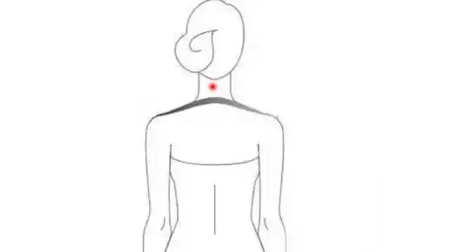 女人后脖子有痣从相学的角度来说,后脖子有痣的人一般有靠山,此人不