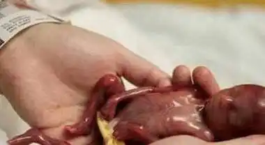 p>2006年10月,一位未满六个月怀孕的准妈妈踏进了迈阿密的一家医院.