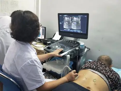 图|b超筛查泌尿系统b超,可以非常敏感地发现3毫米以上的结石,如果尿