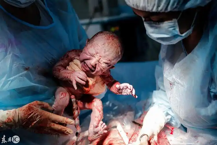 心疼,剖腹产生孩子全过程,看着都疼!男人请好好疼爱自己的老婆