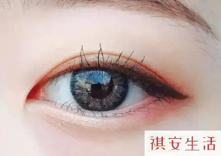 为什么下眼睑有一个小洞3