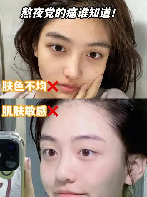 谁有71普通人熬夜脸拯救秘诀