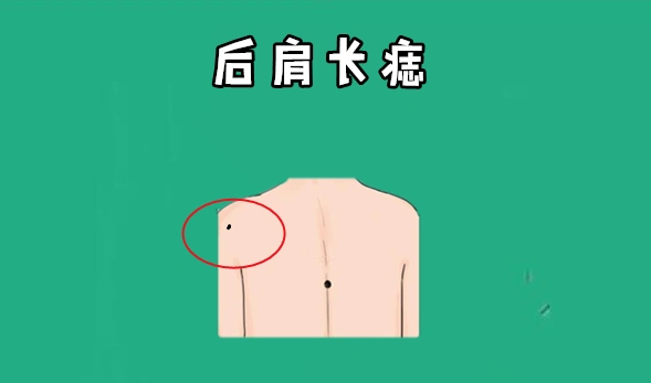 若是在肩膀处的位置长有自己,则通常代表的是一个人的田宅吉痣等,家里