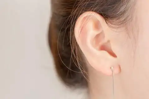 耳轮外翻的人好不好