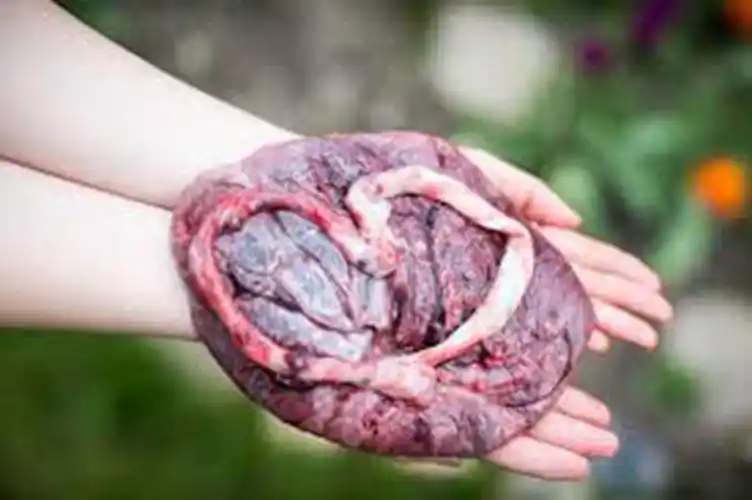 人胎盘详细的特征图片