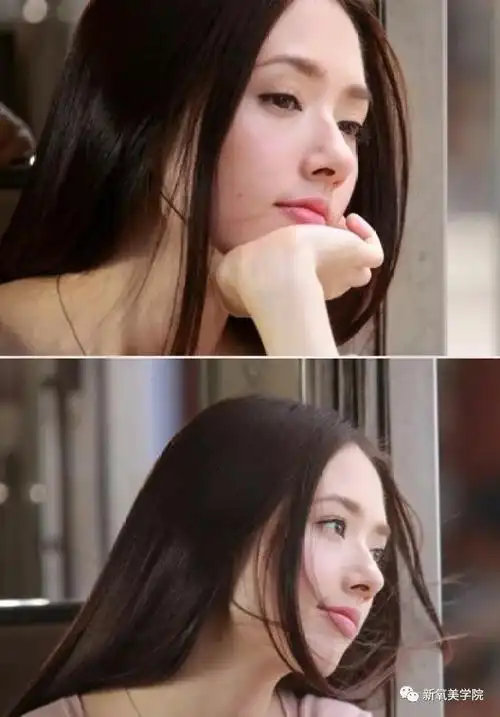 郭碧婷现在凸嘴 下巴后缩,是戴牙套造成的吗?