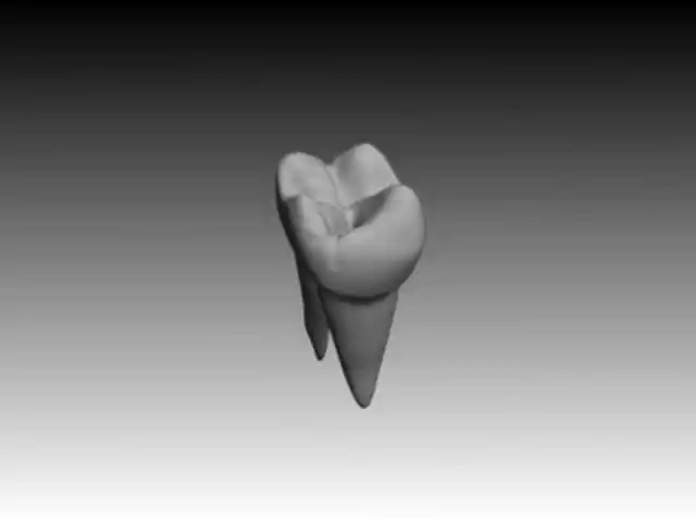 第一磨牙上颌骨3d模型