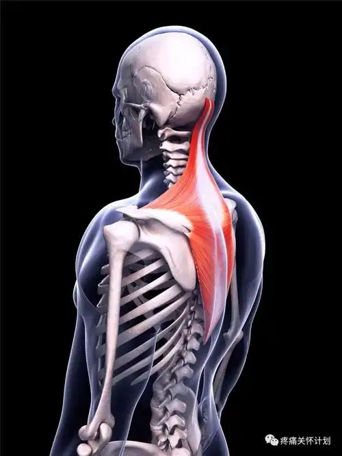 直击头痛,肩凉—斜方肌(全面解析)