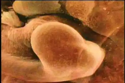 看宝宝的手如何成形图