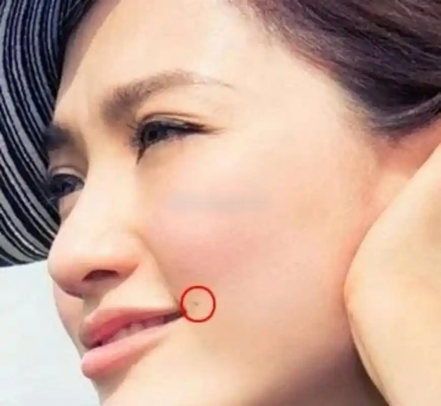 你的嘴巴附近有痣吗?