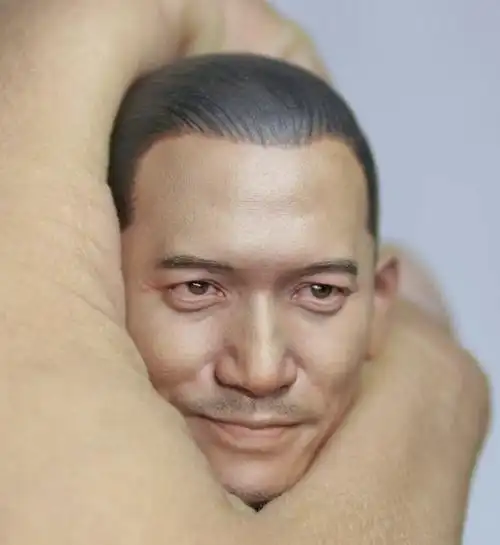 nancy16陈永仁头雕待植发