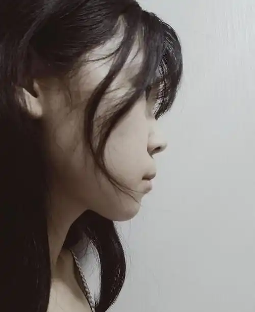 侧脸,鼻子不好看,嘴巴也凸