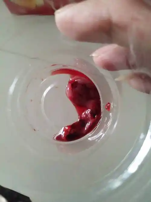 怀孕了不想要孩子,医院给开了打胎药 今天这流出来的是不是孕囊? 急!