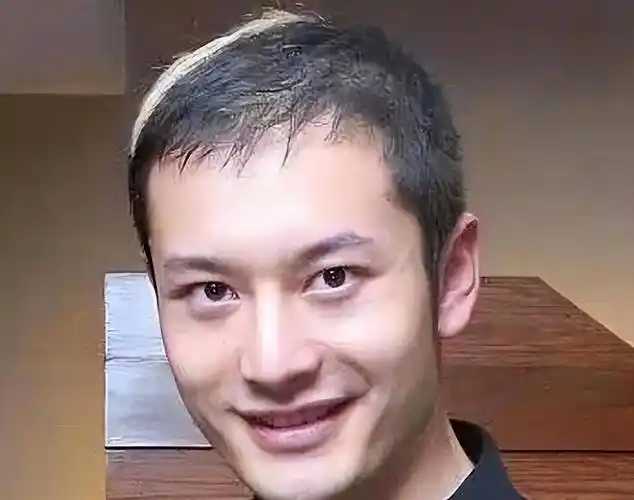 黄晓明原本发量就不多,加上发际线高,只要一不戴假发就很容易显老.