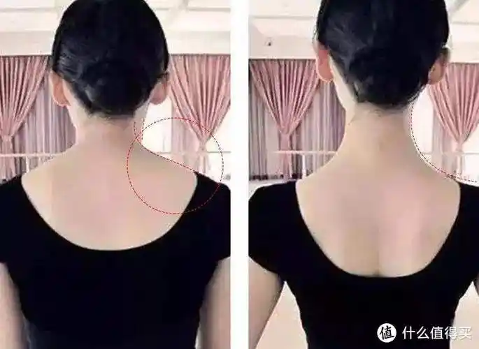斜方肌如何改善看完你就明白了