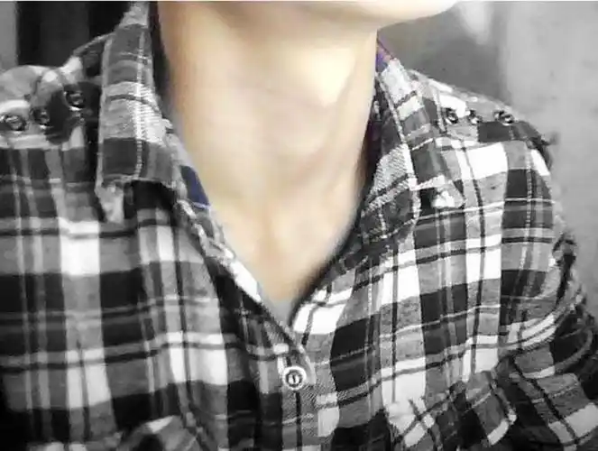 治疗喉结炎的方法