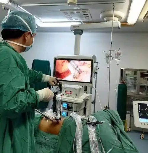 云梦县人民医院泌尿外科成功完成一例腹腔镜半尿路切除术