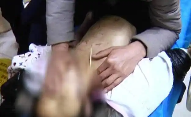 4岁女孩因和奶奶太亲近被亲生妈妈虐打致死组图