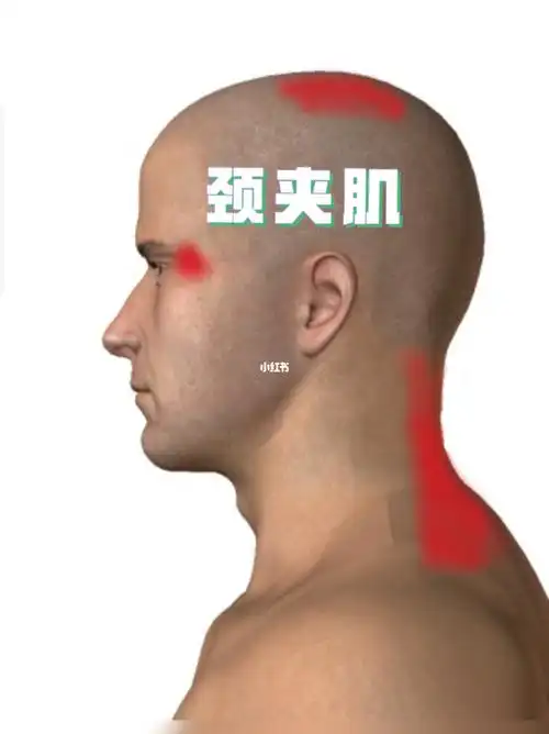 颈夹肌