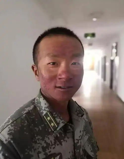 演练,他们的皮肤被强日光灼伤了,这种灼伤不仅仅是"高原红"的印记