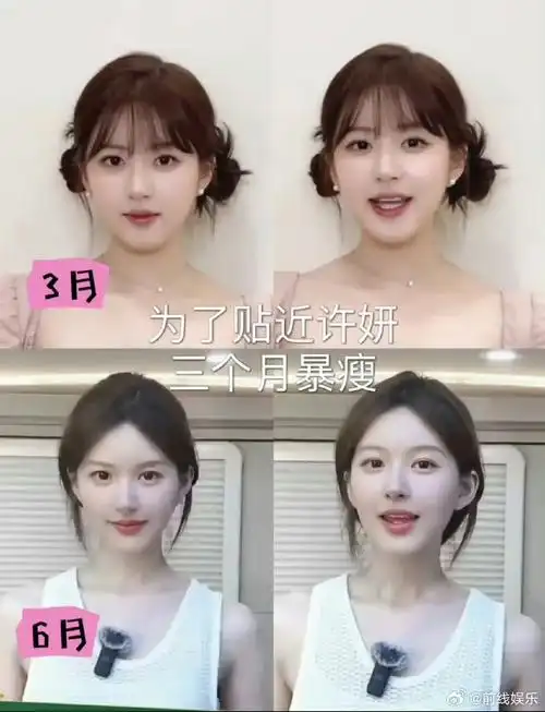 赵露思三个月前后变化,肉眼可见的脸部轮廓更加清晰了,怎么做到的