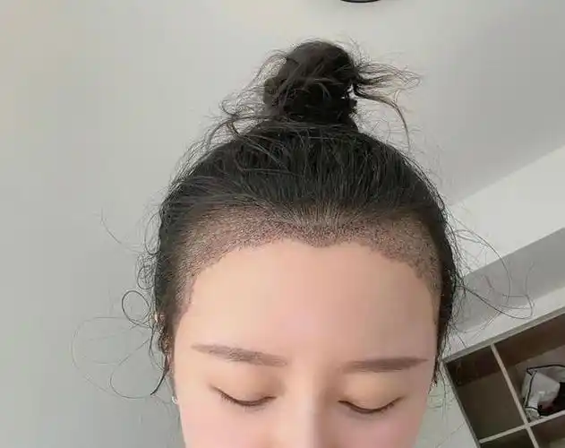 你是什么型"发际线"?桃心颜值高,m型更适合法式刘海