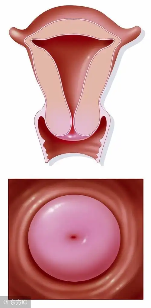 宫颈肥大是怎么形成的