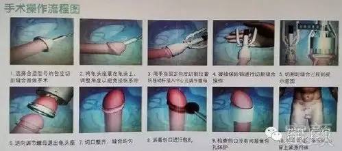 亲爱的小小孩,你的包皮真的需要手术吗?