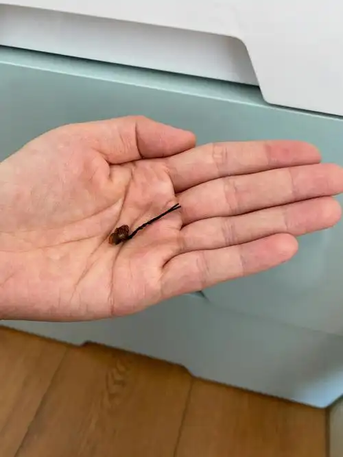 历经70天宝宝脐带终于脱落啦