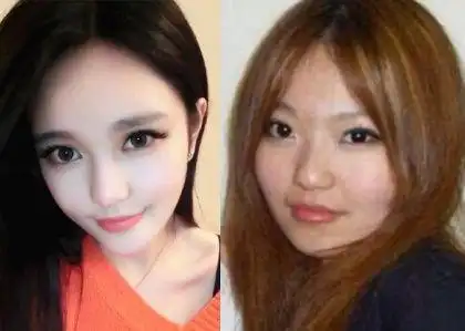 周扬青整容前后对比照