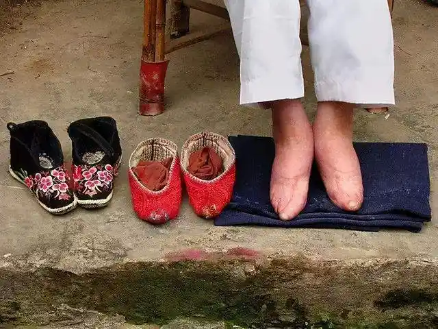 流行了千年之久的小脚妇女审美陋习和习惯才完全被抛弃,这是时代的