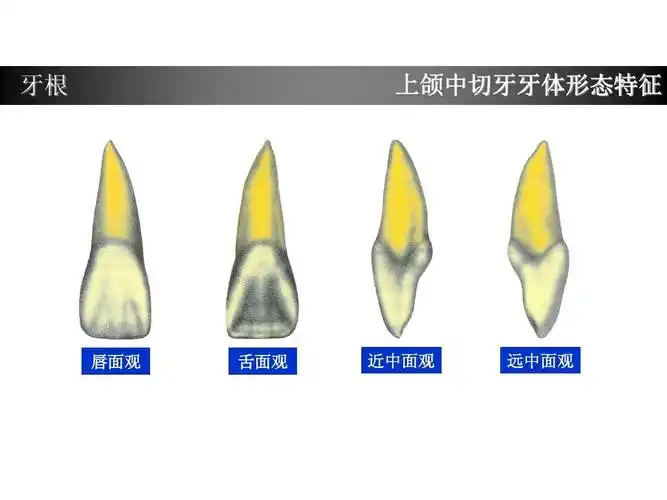 上颌中切牙形态特征简述ppt
