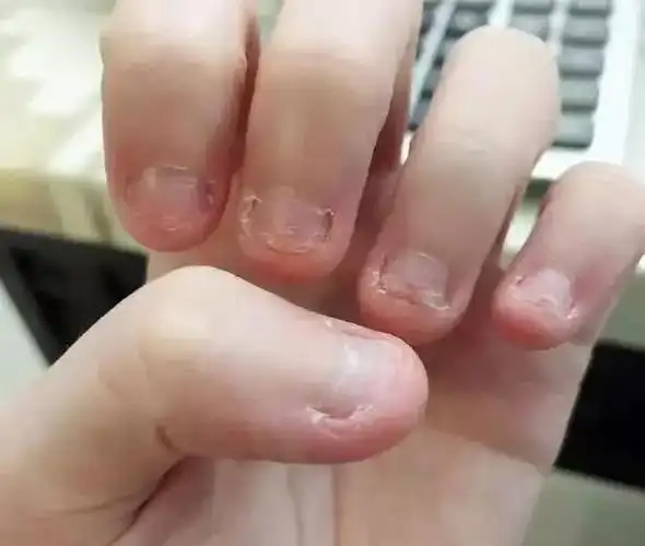 啃指甲,吃手,咬铅笔……孩子小动作背后暗藏心理问题,要警惕