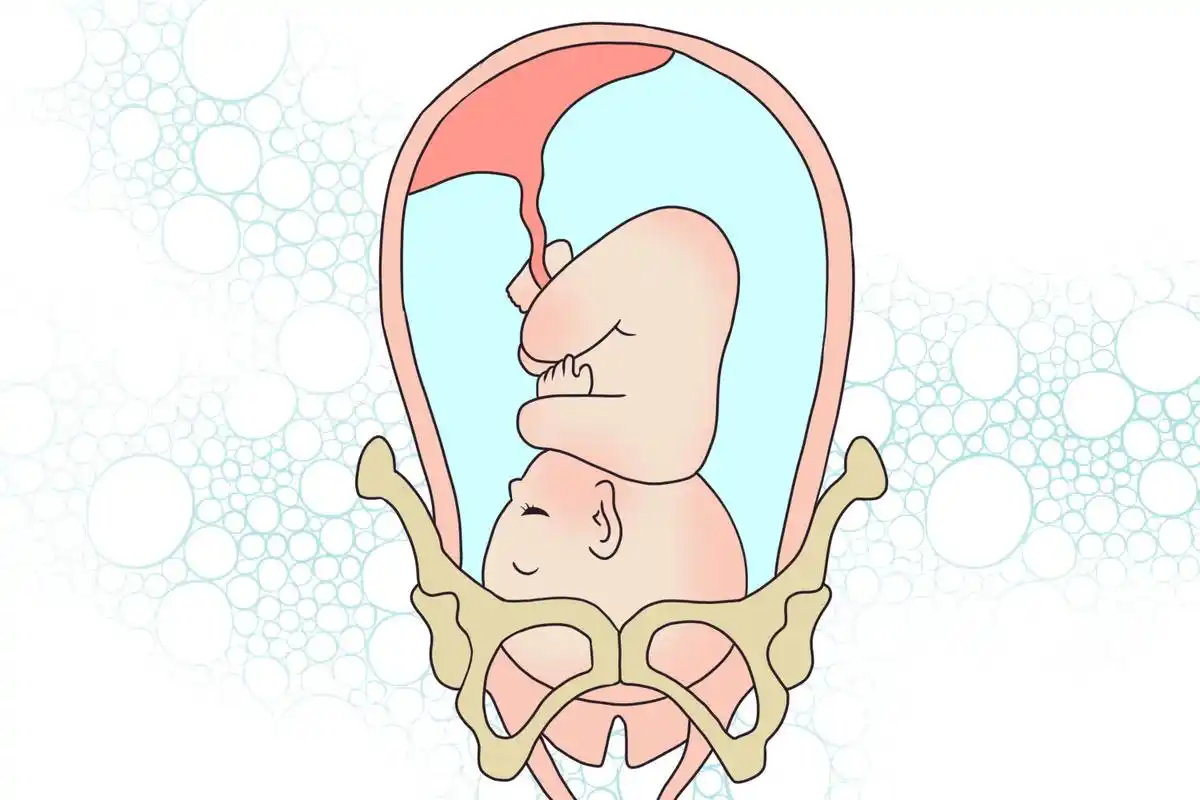 高效备孕!胎儿入盆图"千山万水"-第1张图片-天成博客