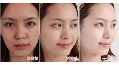 肌肤变紧致了,脸视觉上小了一圈.