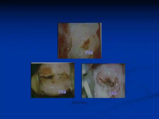 妇科疾病图片ppt学习教案